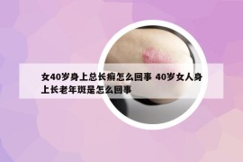 女40岁身上总长癣怎么回事 40岁女人身上长老年斑是怎么回事