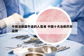 中国治癣最牛逼的人是谁 中国十大治癣药膏品牌