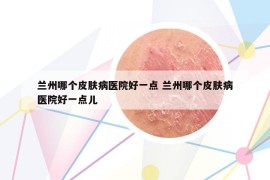 兰州哪个皮肤病医院好一点 兰州哪个皮肤病医院好一点儿