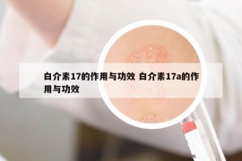 白介素17的作用与功效 白介素17a的作用与功效