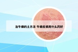 治牛癞的土方法 牛癞皮病用什么药好