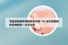 甘肃皮肤病生物制剂多少钱一针 治疗皮肤病的生物制剂一针多少钱