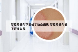 梦见后脑勺下面长了块白癜风 梦见后脑勺长了好多白发