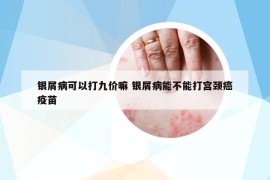 银屑病可以打九价嘛 银屑病能不能打宫颈癌疫苗