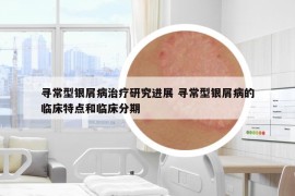 寻常型银屑病治疗研究进展 寻常型银屑病的临床特点和临床分期