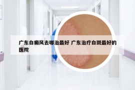 广东白癜风去哪治最好 广东治疗白斑最好的医院