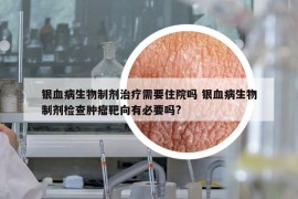 银血病生物制剂治疗需要住院吗 银血病生物制剂检查肿瘤靶向有必要吗?