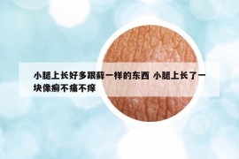 小腿上长好多跟藓一样的东西 小腿上长了一块像癣不痛不痒