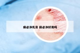 癣必净乳膏 藓必净好用吗