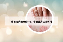 看银屑病注意些什么 看银屑病挂什么科