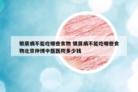 银屑病不能吃哪些食物 银屑病不能吃哪些食物北京仲博中医医院多少钱