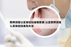 教师资格认定体检标准银屑病 认定教师资格人员体检标准及办法