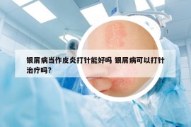 银屑病当作皮炎打针能好吗 银屑病可以打针治疗吗?