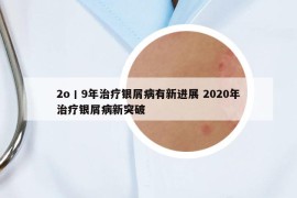 2o丨9年治疗银屑病有新进展 2020年治疗银屑病新突破