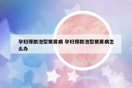 孕妇得脓泡型银屑病 孕妇得脓泡型银屑病怎么办