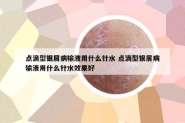 点滴型银屑病输液用什么针水 点滴型银屑病输液用什么针水效果好