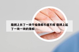 胳膊上长了一块干燥像癣不痛不痒 胳膊上起了一块一块的像癣