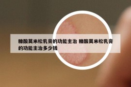 糠酸莫米松乳膏的功能主治 糠酸莫米松乳膏的功能主治多少钱