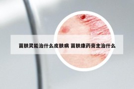 苗肤灵能治什么皮肤病 苗肤康药膏主治什么