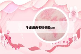 牛皮癣患者喝德国pm