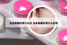 治皮癣最好用什么药 治皮癣最好用什么药膏