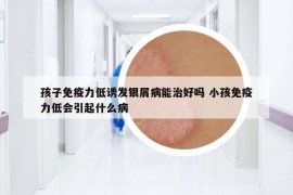 孩子免疫力低诱发银屑病能治好吗 小孩免疫力低会引起什么病