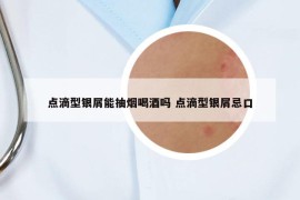 点滴型银屑能抽烟喝酒吗 点滴型银屑忌口