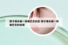 脖子像长癣一样皱巴巴的皮 脖子像长癣一样皱巴巴的皮痒