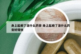 身上起癣了涂什么药膏 身上起癣了涂什么药膏好得快