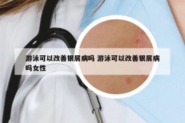 游泳可以改善银屑病吗 游泳可以改善银屑病吗女性