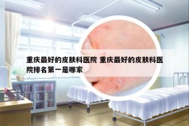 重庆最好的皮肤科医院 重庆最好的皮肤科医院排名第一是哪家