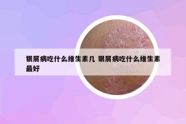 银屑病吃什么维生素几 银屑病吃什么维生素最好