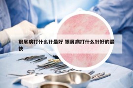 银屑病打什么针最好 银屑病打什么针好的最快