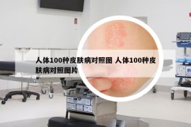 人体100种皮肤病对照图 人体100种皮肤病对照图片