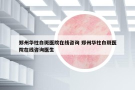 郑州华柱白斑医院在线咨询 郑州华柱白斑医院在线咨询医生