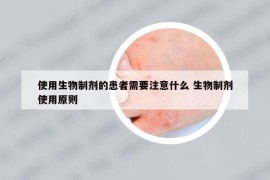 使用生物制剂的患者需要注意什么 生物制剂使用原则