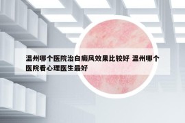 温州哪个医院治白癜风效果比较好 温州哪个医院看心理医生最好