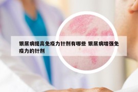 银屑病提高免疫力针剂有哪些 银屑病增强免疫力的针剂