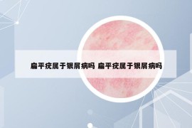 扁平疣属于银屑病吗 扁平疣属于银屑病吗