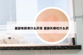 面部有藓用什么药膏 面部长癣吃什么药