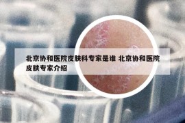 北京协和医院皮肤科专家是谁 北京协和医院皮肤专家介绍