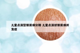 儿童点滴型银屑病分期 儿童点滴状银屑病并发症