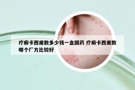 疗癣卡西甫散多少钱一盒国药 疗癣卡西甫散哪个厂方比较好