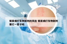 银屑病打生物制剂的风险 银屑病打生物制剂要打一辈子吗