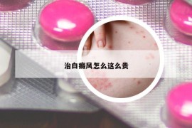 治白癜风怎么这么贵