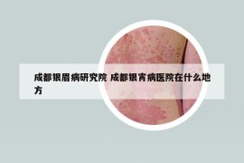 成都银眉病研究院 成都银宵病医院在什么地方