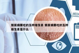 银屑病要吃的五种维生素 银屑病要吃的五种维生素是什么