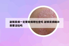 副银屑病一定要做病理检查吗 副银屑病确诊需要活检吗