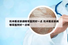 杭州看皮肤病哪家医院好一点 杭州看皮肤病哪家医院好一点呢