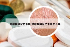 银屑病脑记忆下降 银屑病脑记忆下降怎么办